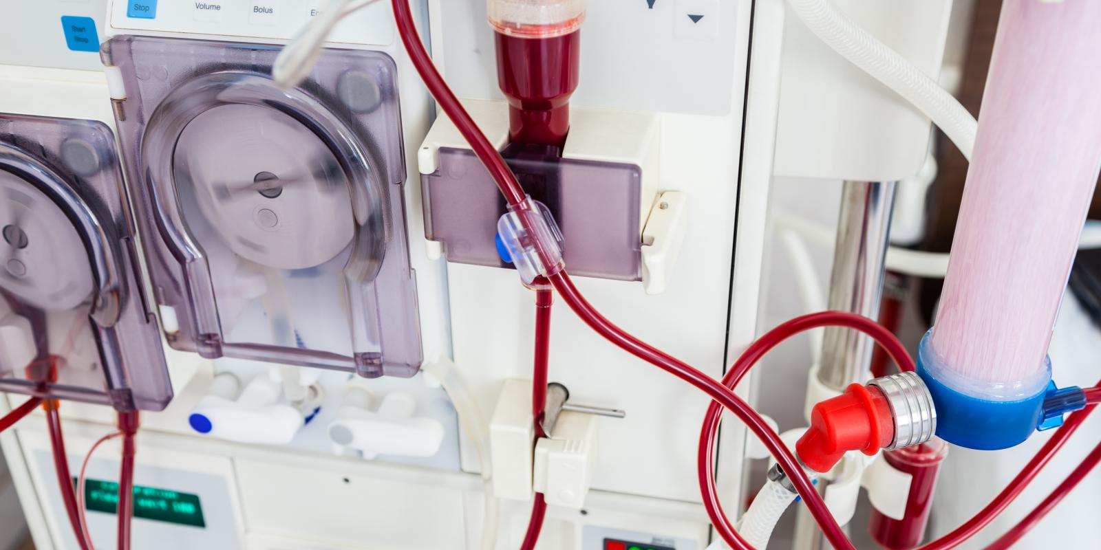 hemodialysis-a-type-of-dialysis-american-kidney-fund
